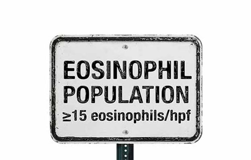 Eosinophil counts alone do not establish an Eosinophilic Esophagitis (EoE) diagnosis.